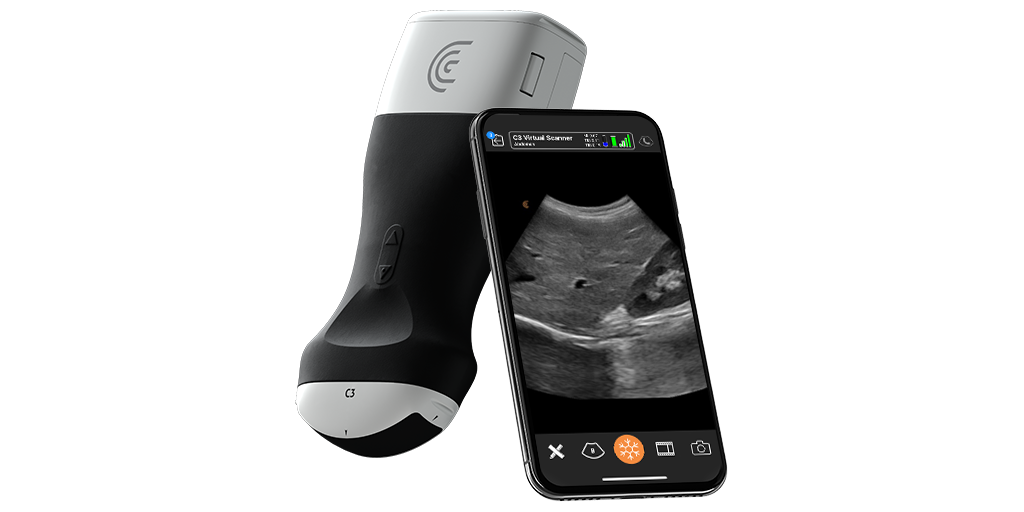 Portable Ultrasound