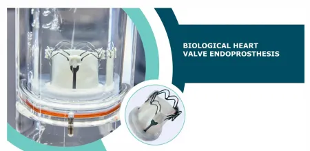 Biological Heart Valve Endoprosthesis