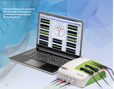 Intraoperative Doppler Device