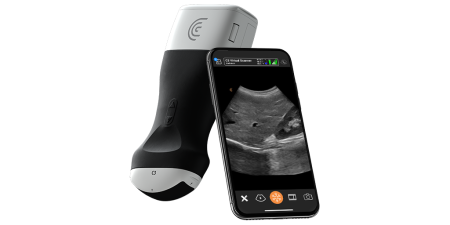 Portable Ultrasound