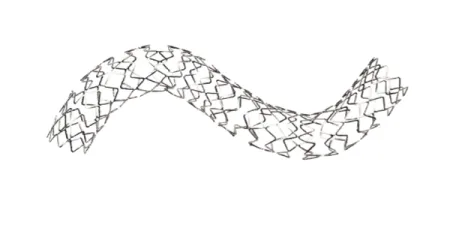 Stent Systems