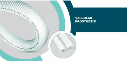 Vascular Prosthesis